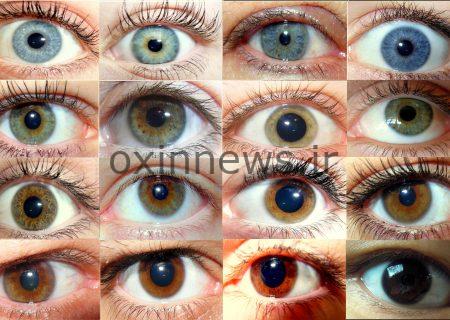 کمیاب‌ترین «رنگ چشم» جهان؟